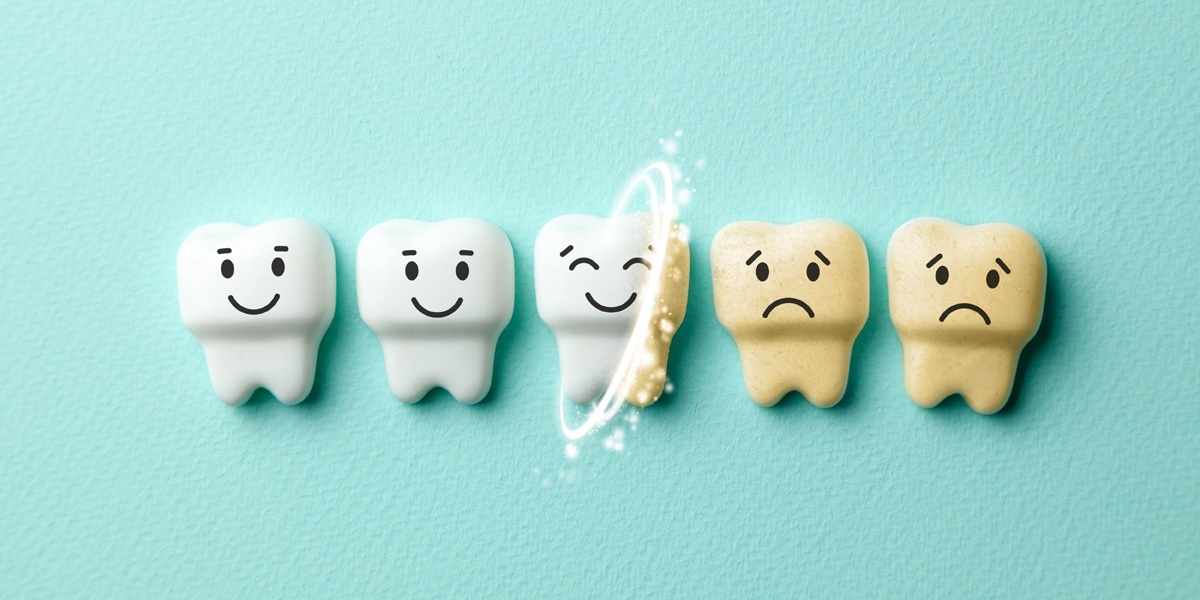 Teeth whitening
