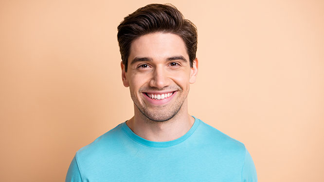 Veneers